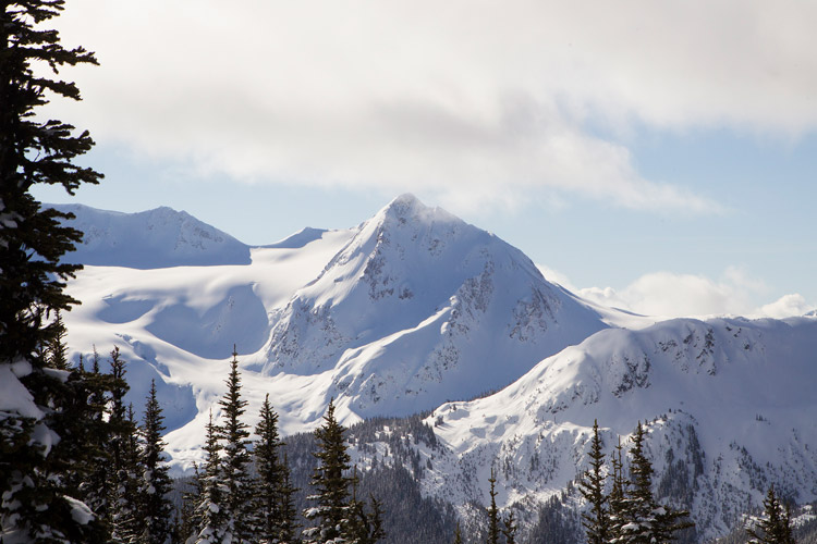 The Whistler Backyard